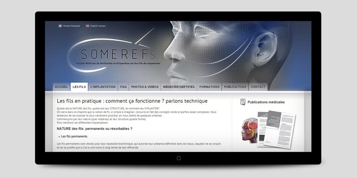 Site Joomla multilingue pour la Somerefs regroupant des médecins esthétiques